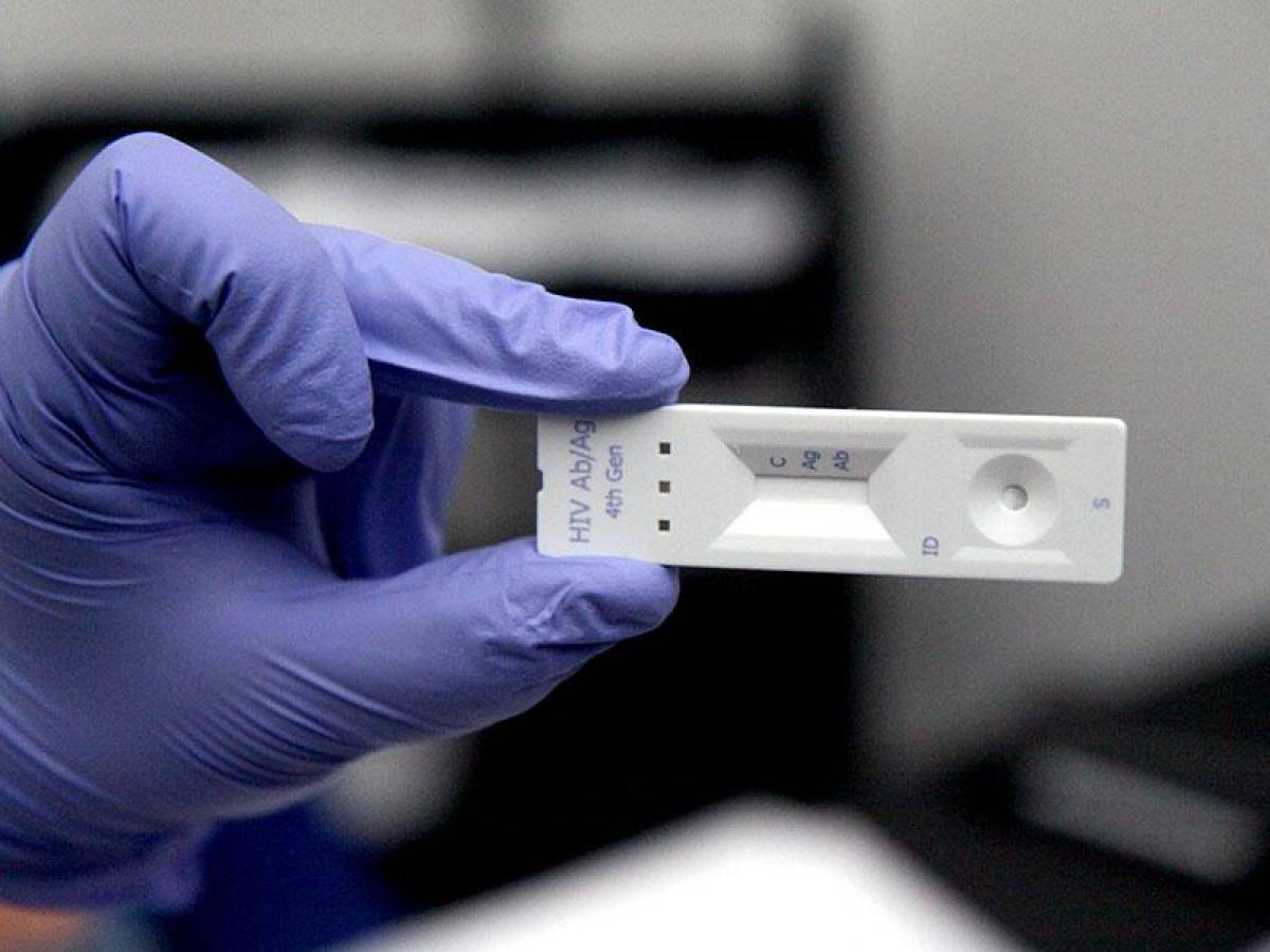 Autotesteo de VIH: lo que necesitas saber antes de hacerte uno